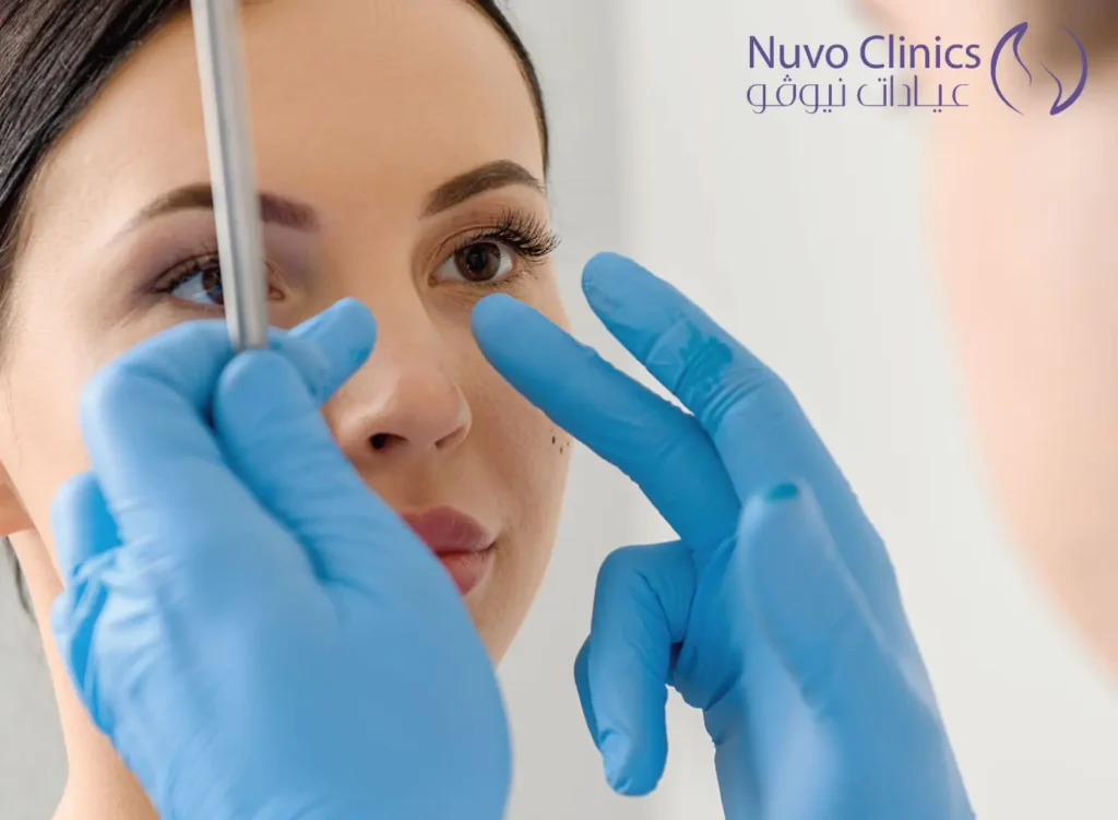 عمليات تجميل الانف العريض