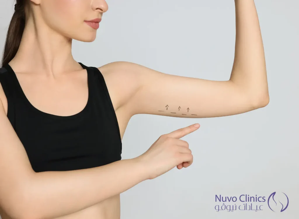 عملية تجميل الذراعين