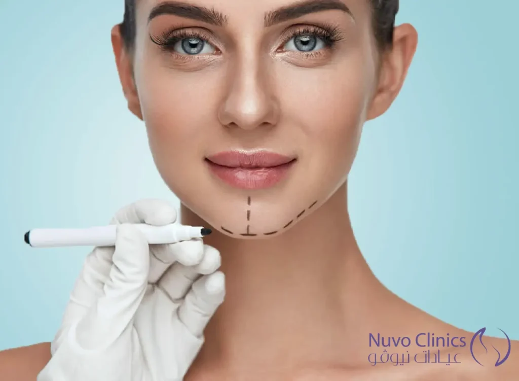 عملية تجميل الذقن
