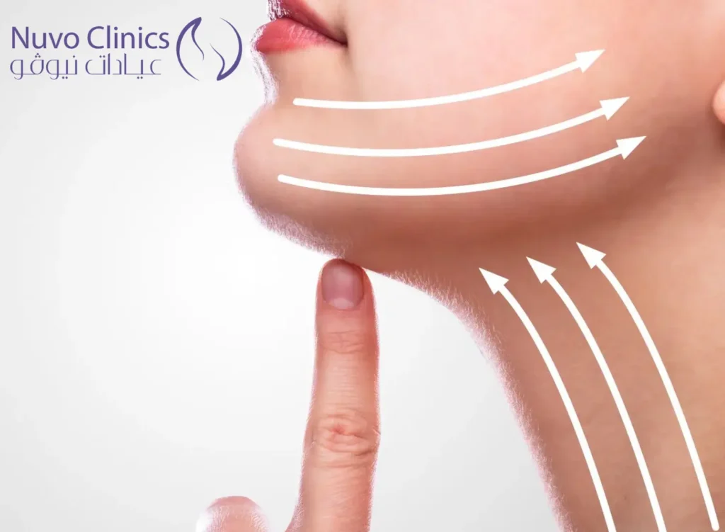 عملية إزالة اللغلوغ