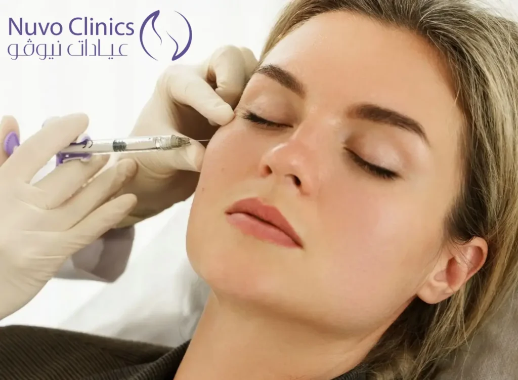 فيلر الخدود