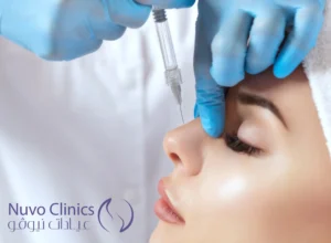 تجربتي مع فيلر الانف