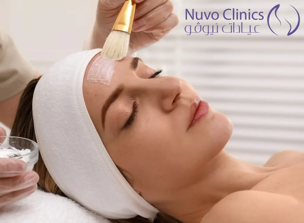 التقشير الكيميائي