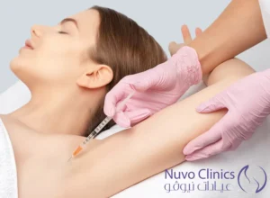 بوتكس التعرق