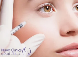 بوتكس العين