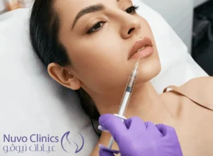 فيلر الياكسين