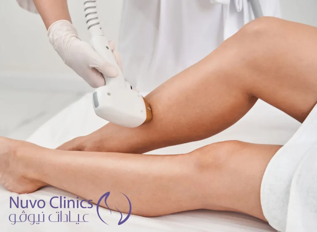 ليزر ازالة الشعر