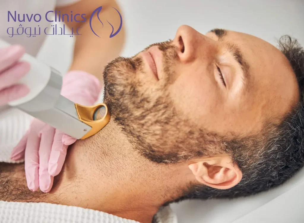 ازالة الشعر بالليزر للرجال